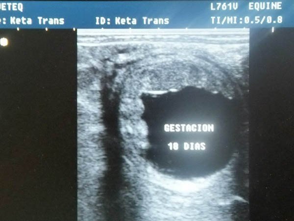 transferencia embriones 04